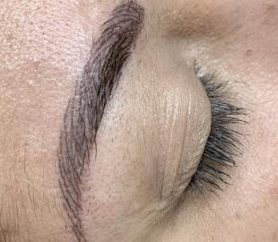 Direkt nach der Korrekturbehandlung