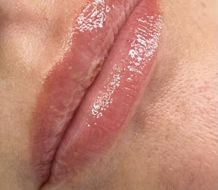 Abgeheiltes Resultat